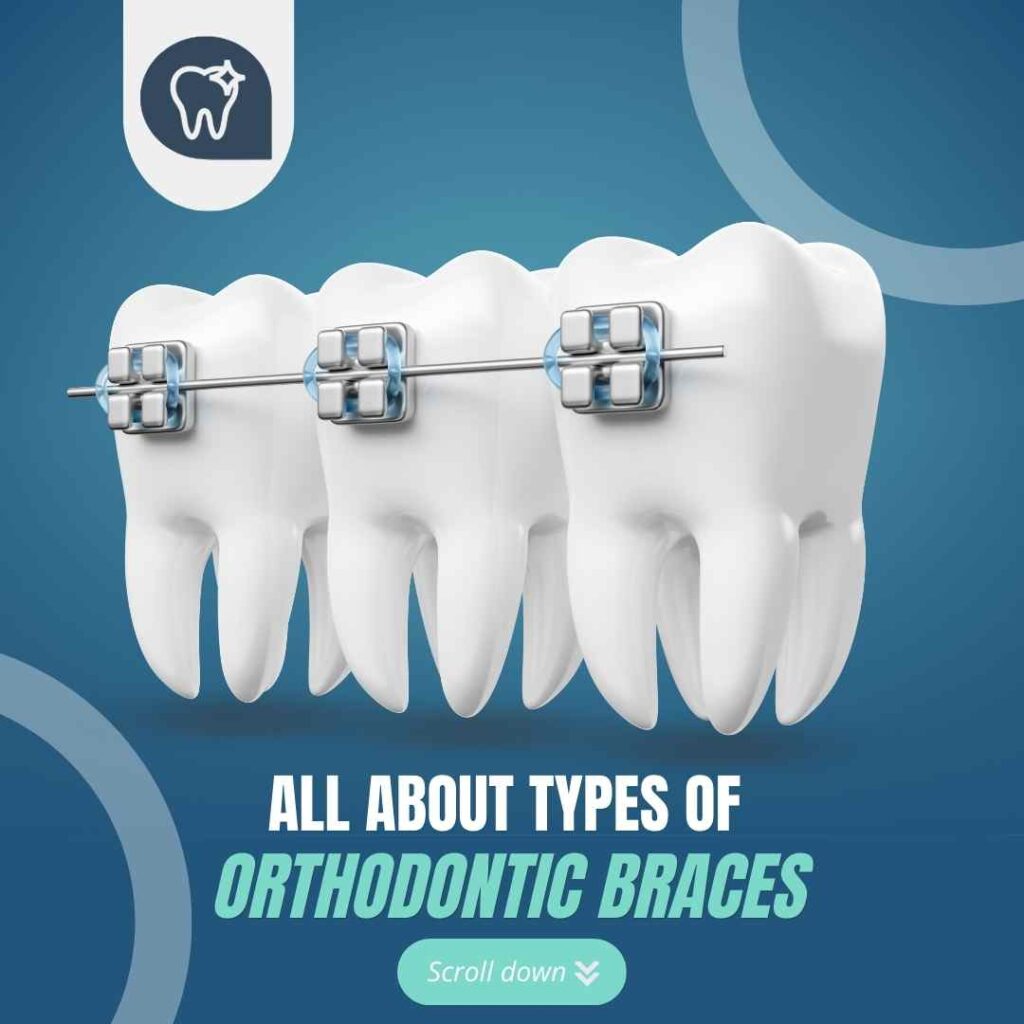 orthodontic treatment in chandigarh