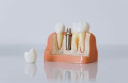 Dental Implants in 2026: Are They the Best Solution for Missing Teeth?